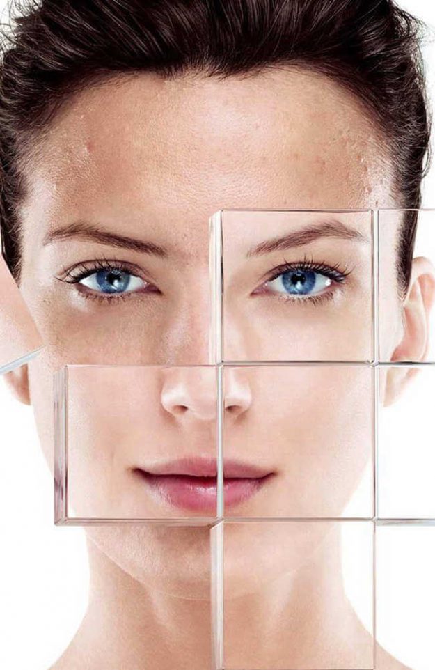 PELLE SEBORROICA VISO