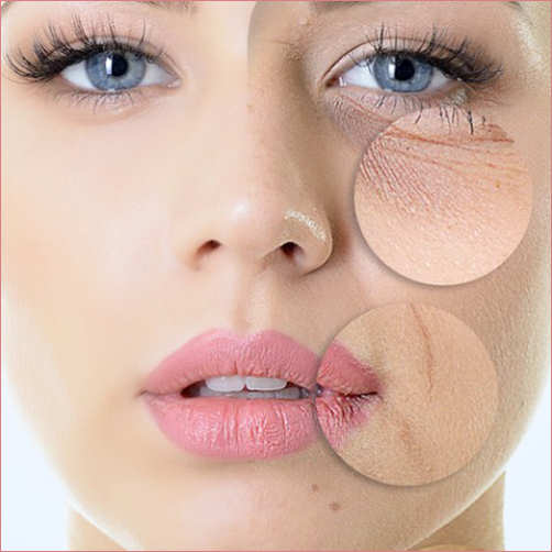 pelle secca e sensibile