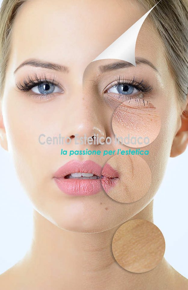 PELLE SEBORROICA VISO