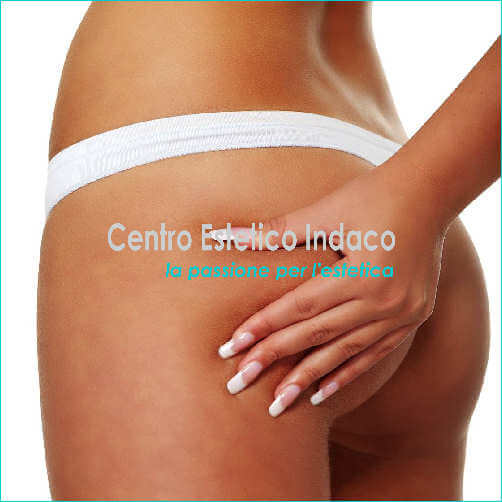 eliminare-la-cellulite