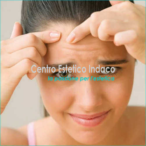 PELLE GRASSA SEBORROICA