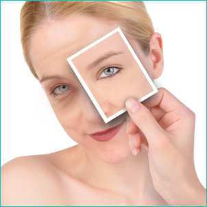 rimedi contro le occhiaie