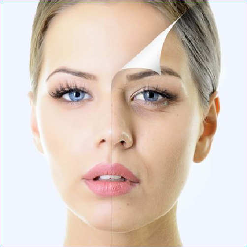 PEELING ACIDO MANDELICO