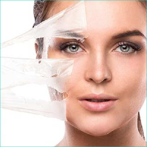 peeling chimico viso