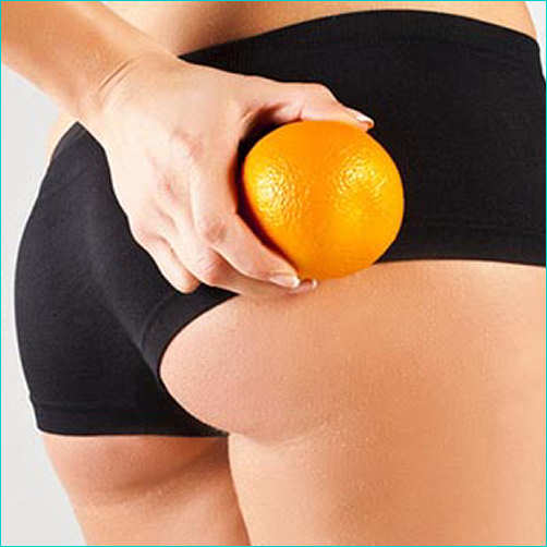 cellulite esercizi