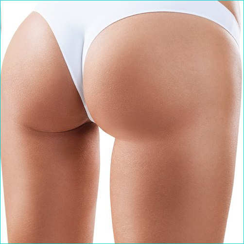 inestetismi cellulite